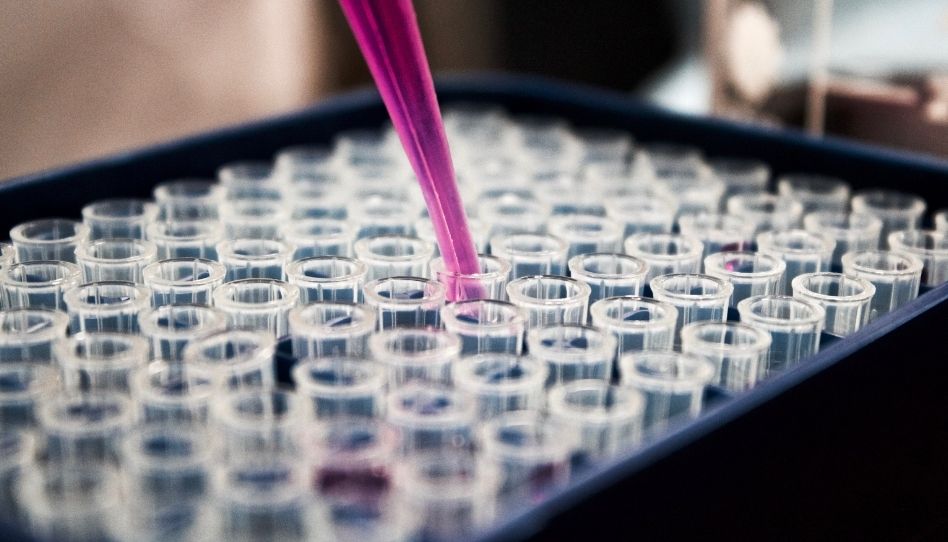 Zu sehen ist ein Tablett, gefüllt mit Reagenzgläsern. In einem von ihnen ist eine Pipette.